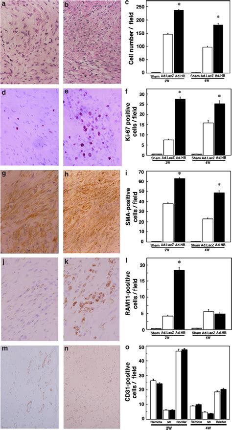 Histological And Immunohistochemical Findings In The MI Area