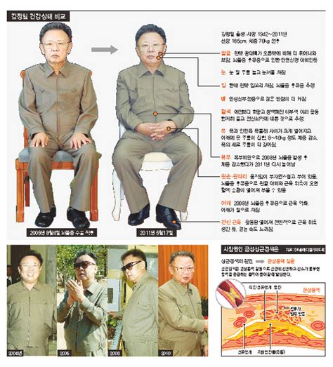Kim Jong Death