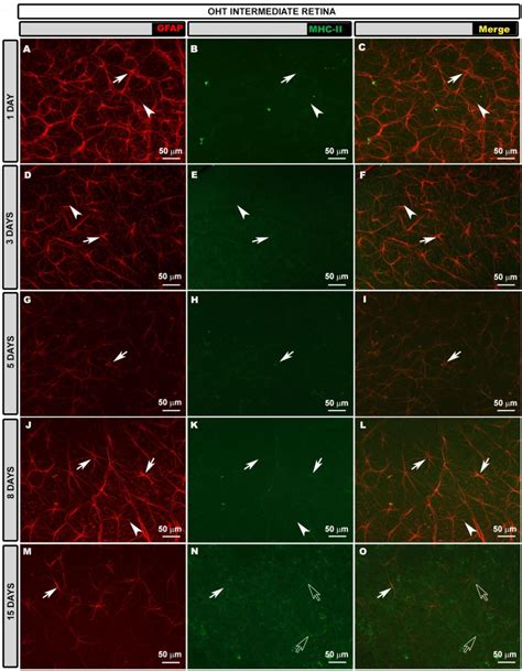 Figure 6 from Retinal Changes in Astrocytes and Müller Glia in a Mouse