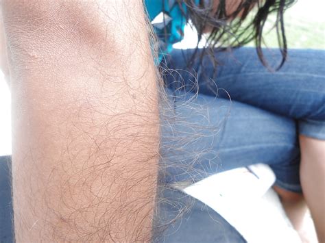 Girl With Very Hairy Arms Porn Pictures XXX Photos Sex Images 1304605 PICTOA