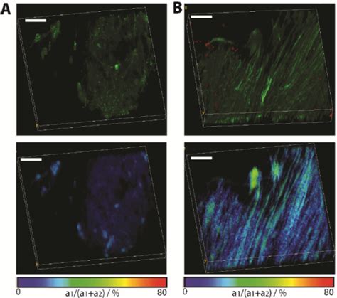 Application Of FRET FLIM In Chronic Neuro Inflammation To Probe