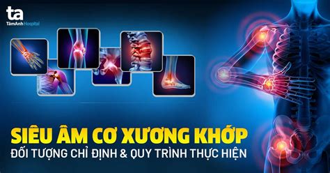 Siêu âm cơ xương khớp Đối tượng chỉ định và quy trình thực hiện