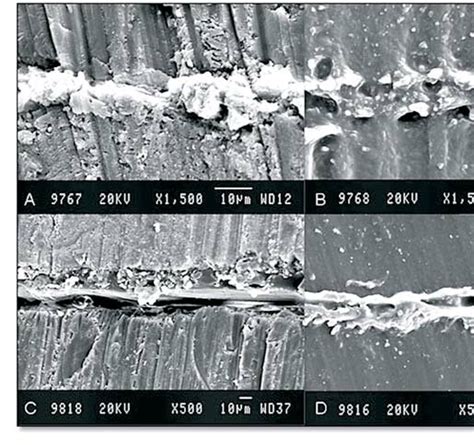 A. SEM image (x1500) illustrating a section of a permanent tooth ...