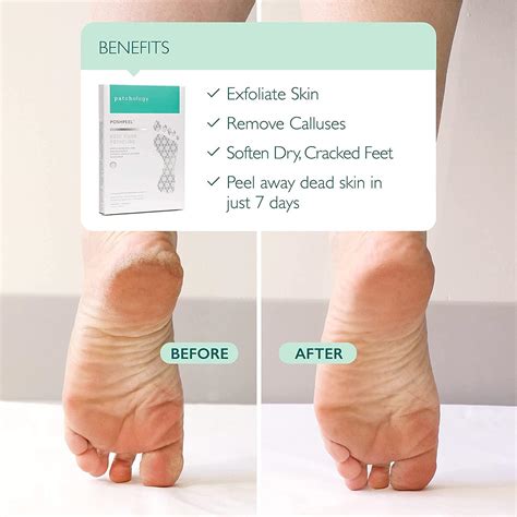 Patchology PoshPeel Pedi Cure XL - Intensive Foot Peel Mask for