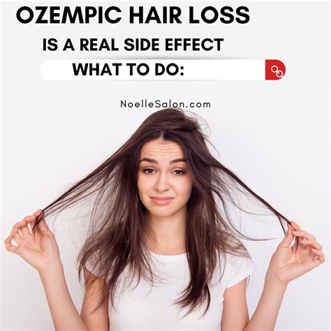 Understanding Ozempic Hair Loss Causes And Solutions Noellesalon