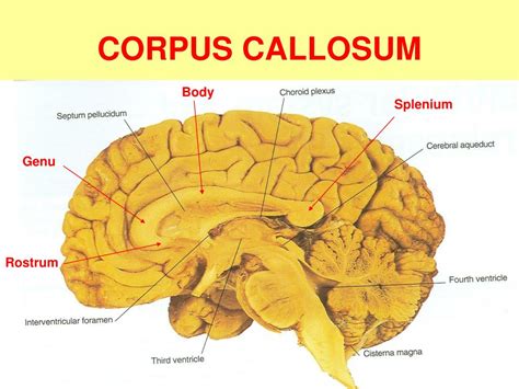 corpus callosum rostrum genu body splenium