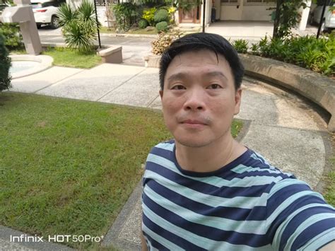 Kelebihan Dan Kekurangan Infinix Hot Pro Si Paling Tipis