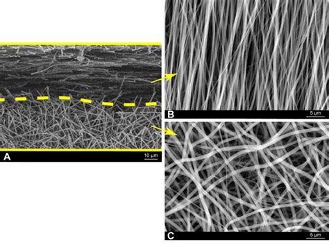 SEM observations of the dual-layer aligned-random nanofibrous scaffold ...