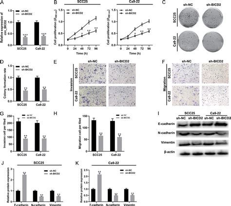 Figure From Circ Bicd Acts As A Cerna To Promote Tumor Progression