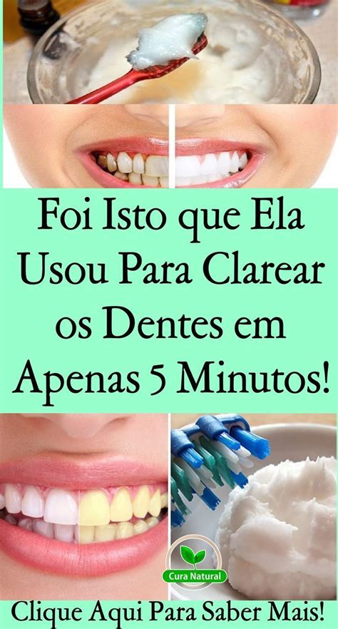Receita Para Deixar O Dente Branco - Receita Simples Para Deixar Dentes Mais Brancos | Cómo blanquear los ...