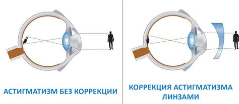 Астигматические контактные линзы: отзывы, цены, можно ли носить обычные ...