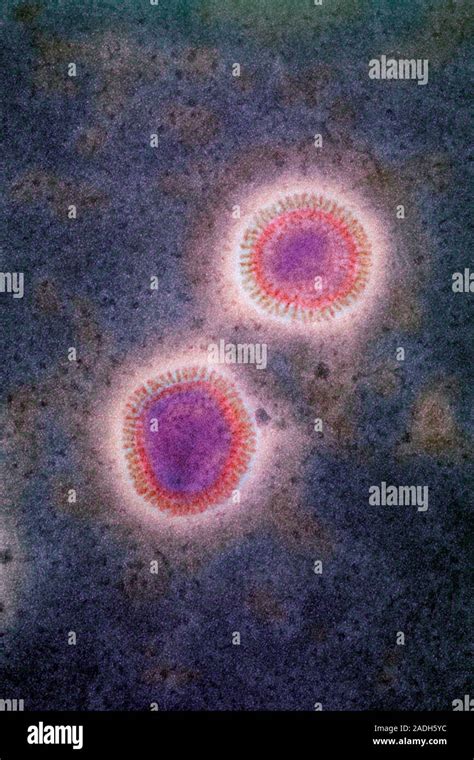 Influenza Viruses Coloured Transmission Electron Micrograph Tem Of A Section Through