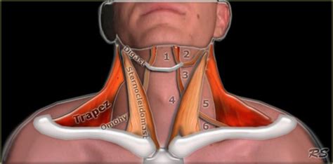 Floor Of Mouth Anatomy Coronal Ctr