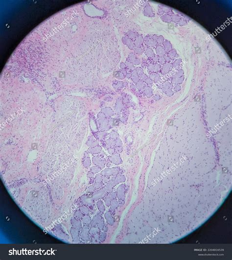Lamina Propria Of The Esophagus Is What Tissue 3