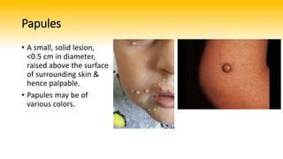 basic skin lesions pptx