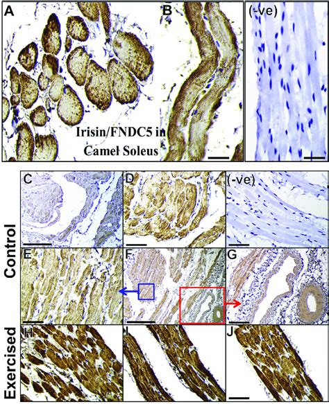 Cellular Localization Of Irisin Fndc In The Soleus Muscles Of The