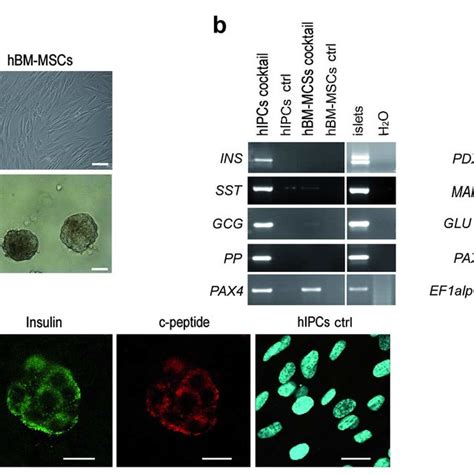 Endocrine Differentiation Potential Of HIPCs And HBM MSCs 3a Cluster