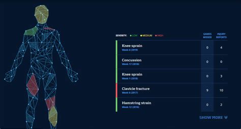 2023 Injury Finder | Top 5 Surprises