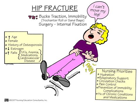 De 25 Bedste Idéer Inden For Hip Fracture På Pinterest Dyrlæger
