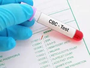 RDW Blood Test - Normal Range, Causes and what does it mean when it is ...