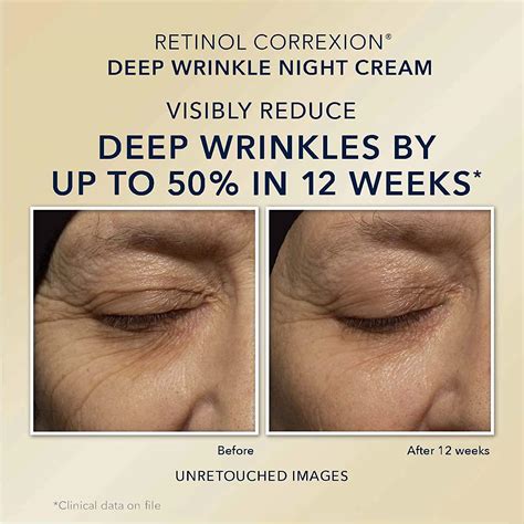 roc retinol  set deep wrinkle night face cream retinol
