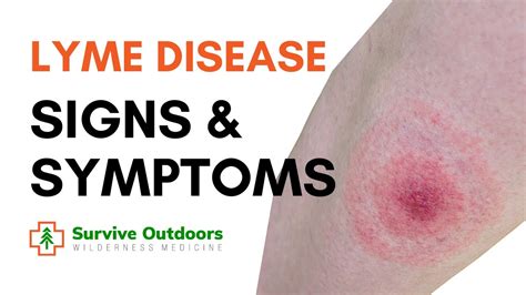 What Are The Symptoms Of Lyme Disease Youtube