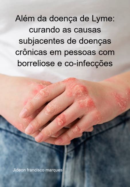 Além da doença de Lyme curando as causas subjacentes de doenças