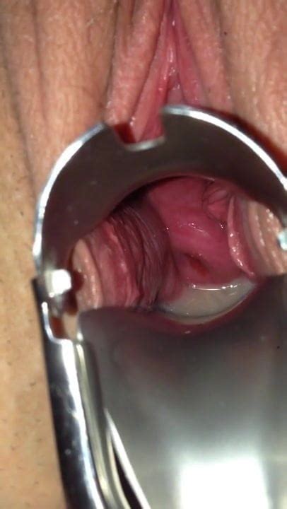 Spekulum Nach Ihrer Besamung Free Doctor Porn XHamster XHamster