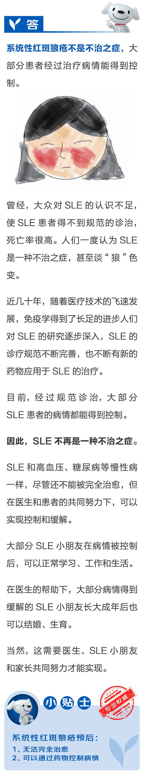 系统性红斑狼疮是不治之症吗？ 京东健康