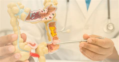 Mortes Por C Ncer Colorretal Crescem Na Am Rica Latina