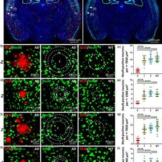 Neunpositive Neuronal Loss Is Restricted To The Core Area Of A