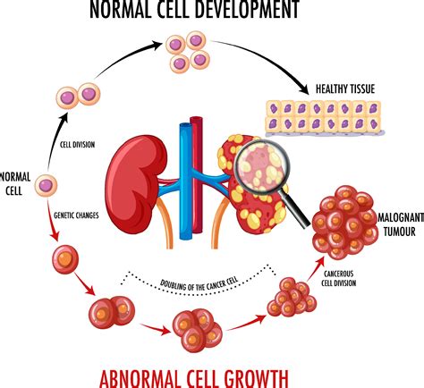 Diagramme Montrant Une Cellule Normale Et Une Cellule Cancéreuse 6772730 Art Vectoriel Chez Vecteezy