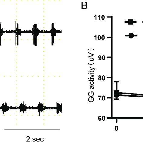 The Genioglossus EMG Activity Of NO And CIH Groups A Typical