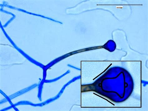 Fun With Microbiology What S Buggin You Apophysomyces Elegans