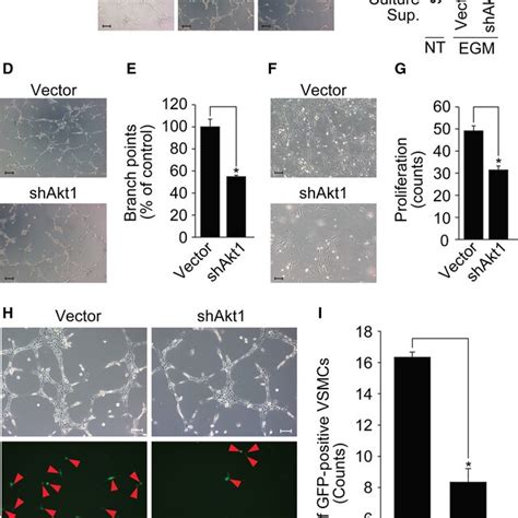 Akt Regulates Mural Cell Coverage And Hemorrhage Retinas Were