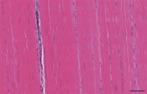 Lecture 9 Diagnosis And Management Of Equine Tendon And Ligament