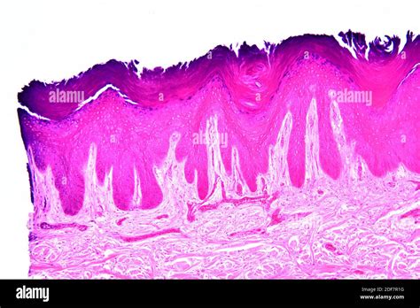 Stratified Squamous Epithelium Keratinized 400x