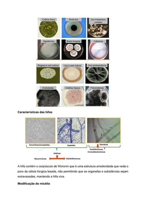 Solution Caracter Sticas Gerais Dos Fungos Morfologia Studypool