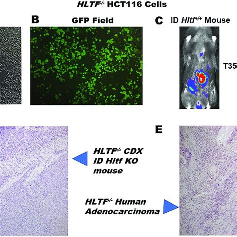 Hltf Hct Red Fluc Cells Hltf Cdx Tme Model And Human Primary