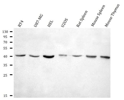 anti-XCR1 CCXCR1 antibody (ARG43803) - arigo Biolaboratories