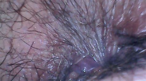 Hairy Ass Exploration With Endoscope And Farts K Avi Nicoletta Embassi Clips Sale