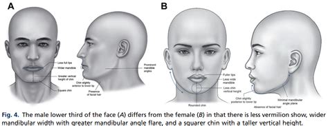 Upper Lip Width – Why is a smaller upper lip width better than a larger ...