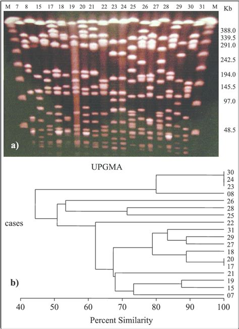 PFGE Profiles Of SmaI Digested Genomic DNA Of 18 Staphylococcus Aureus