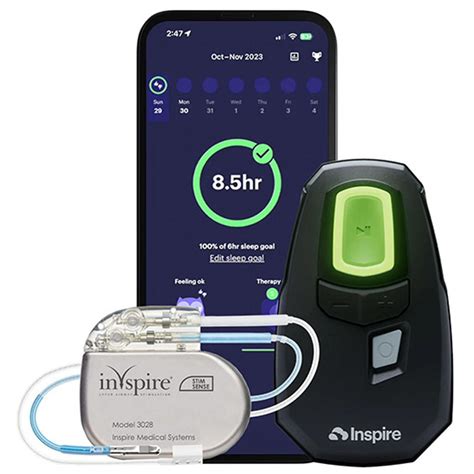 Inspire Sleep Apnea Innovation - Obstructive Sleep Apnea Treatment