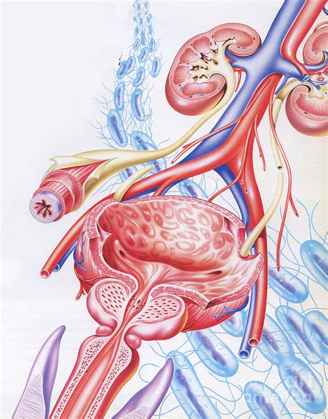 Male Urinary Tract Infection Photograph By John Bavosi Science Photo