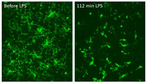 Microglial Dynamics Neurotar