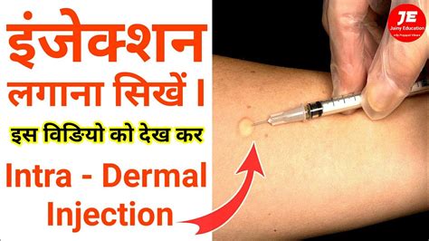 Intradermal Injection Kaise Lagate Hain इंजेक्शन कैसे लगाते हैं How