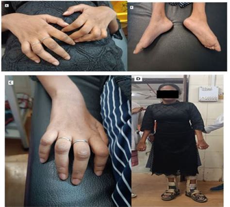 journal  clinical images  medical case reports