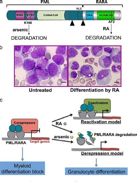 [pdf] Acute Promyelocytic Leukemia Arsenic And Pml Bodies Semantic Scholar