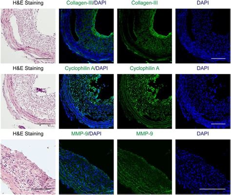 Surrogate markers of synthetic vascular smooth muscle cells in... | Download Scientific Diagram